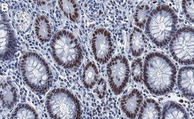 Anti-MLH1 Antibody, clone 1B15 ZooMAb&#174; Rabbit Monoclonal recombinant, expressed in HEK 293 cells