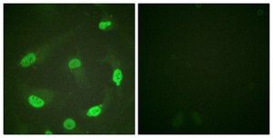 Anti-p53 (Acetyl-Lys379), C-Terminal antibody produced in rabbit affinity isolated antibody