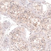 Monoclonal Anti-SOX6 antibody produced in mouse Prestige Antibodies&#174; Powered by Atlas Antibodies, clone CL5690, purified immunoglobulin, buffered aqueous glycerol solution