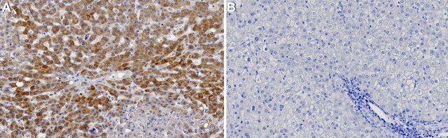 Anti-CHCHD10 Antibody, clone 3J12 ZooMAb&#174; Rabbit Monoclonal recombinant, expressed in HEK 293 cells