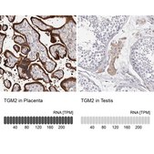 Anti-TGM2 antibody produced in rabbit Prestige Antibodies&#174; Powered by Atlas Antibodies, affinity isolated antibody, buffered aqueous glycerol solution
