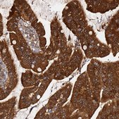 Anti-PRKAB2 antibody produced in rabbit Prestige Antibodies&#174; Powered by Atlas Antibodies, affinity isolated antibody, buffered aqueous glycerol solution