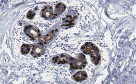 Anti-FASN Antibody, clone 2C13 ZooMAb® Rabbit Monoclonal recombinant, expressed in HEK 293 cells