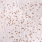 Monoclonal Anti-Foxo3 Antibody Produced In Mouse Prestige Antibodies&#174; Powered by Atlas Antibodies, clone CL13589, affinity isolated antibody, buffered aqueous glycerol solution