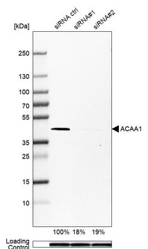 Monoclonal Anti-ACAA1 antibody produced in mouse Prestige Antibodies&#174; Powered by Atlas Antibodies, clone CL2660, purified immunoglobulin, buffered aqueous glycerol solution