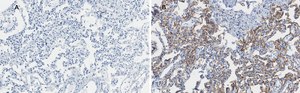 Anti-Integrin alpha V beta 6 Antibody, clone EM05201, ZooMAb® Rabbit Monoclonal recombinant, expressed in HEK 293 cells
