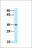 Anti-GNAO1 antibody produced in rabbit affinity isolated antibody