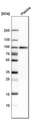 Anti-C1S antibody produced in rabbit Prestige Antibodies&#174; Powered by Atlas Antibodies, affinity isolated antibody, buffered aqueous glycerol solution