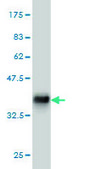 Monoclonal Anti-ACVR1B antibody produced in mouse clone 1C1, purified immunoglobulin, buffered aqueous solution