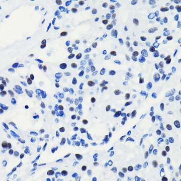 Anti-BRG1/SMARCA4 antibody produced in rabbit