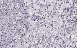 Anti-MerTK Antibody, clone 2E14 ZooMAb&#174; Rabbit Monoclonal recombinant, expressed in HEK 293 cells