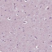 Anti-CGA antibody produced in rabbit Prestige Antibodies&#174; Powered by Atlas Antibodies, affinity isolated antibody, buffered aqueous glycerol solution