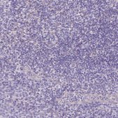Anti-PNLIP antibody produced in rabbit Prestige Antibodies&#174; Powered by Atlas Antibodies, affinity isolated antibody, buffered aqueous glycerol solution