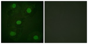 Anti-p53 antibody produced in rabbit affinity isolated antibody