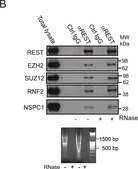 Anti-REST Antibody Upstate&#174;, from rabbit