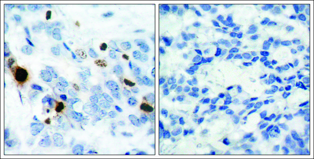 Anti-phospho-HIST1H3D (pSer10) antibody produced in rabbit affinity isolated antibody