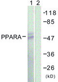 Anti-PPAR-&#945; antibody produced in rabbit affinity isolated antibody