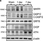 Monoclonal Anti-ATF4 antibody produced in mouse clone 2B3, purified immunoglobulin, buffered aqueous solution
