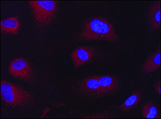 Anti-Beclin 1 (N-terminal) antibody produced in rabbit IgG fraction of antiserum, buffered aqueous solution
