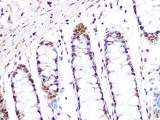 Anti-PRMT1 antibody produced in rabbit