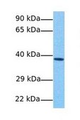 Anti-GNAI1 antibody produced in rabbit affinity isolated antibody