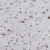 Anti-TOP2B antibody produced in rabbit Prestige Antibodies&#174; Powered by Atlas Antibodies, affinity isolated antibody, buffered aqueous glycerol solution