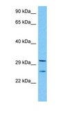 Anti-TAL1 (AB2) antibody produced in rabbit affinity isolated antibody