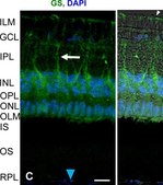 Anti-Glutamine Synthetase Antibody, clone GS-6 clone GS-6, Chemicon&#174;, from mouse