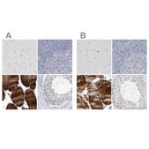 Anti-MYOT antibody produced in rabbit Prestige Antibodies&#174; Powered by Atlas Antibodies, affinity isolated antibody, buffered aqueous glycerol solution