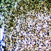 Anti-phospho-HER2 (pTyr1221/Tyr1222) antibody produced in rabbit affinity isolated antibody