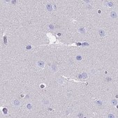 Anti-CYP51A1 antibody produced in rabbit Prestige Antibodies&#174; Powered by Atlas Antibodies, affinity isolated antibody, buffered aqueous glycerol solution