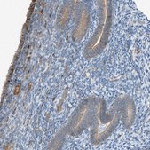 Anti-DYRK1A antibody produced in rabbit Prestige Antibodies&#174; Powered by Atlas Antibodies, affinity isolated antibody, buffered aqueous glycerol solution