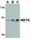 Anti-BTK antibody produced in rabbit affinity isolated antibody, buffered aqueous solution