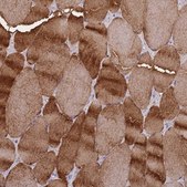Anti-CKM antibody produced in rabbit Prestige Antibodies&#174; Powered by Atlas Antibodies, affinity isolated antibody, buffered aqueous glycerol solution