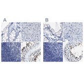 Anti-HOOK1 antibody produced in rabbit Prestige Antibodies&#174; Powered by Atlas Antibodies, affinity isolated antibody, buffered aqueous glycerol solution, Ab2