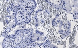 Anti-eNOS Antibody, clone 2F12 ZooMAb® Rabbit Monoclonal recombinant, expressed in HEK 293 cells