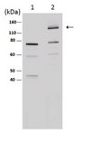 Anti-iNOS/NOS II Antibody, NT from rabbit, purified by affinity chromatography