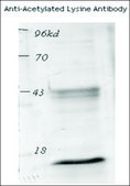 Anti-Acetylated Lysine antibody produced in rabbit 1&#160;mg/mL, affinity isolated antibody