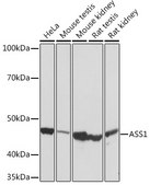 Anti-ASS1 Antibody, clone 4W1M8, Rabbit Monoclonal