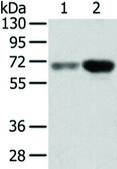 Anti-TBL1X affinity isolated antibody