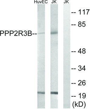 Anti-PPP2R5D antibody produced in rabbit affinity isolated antibody