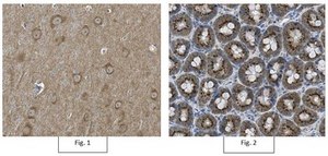 Anti-Metabotropic Glutamate Receptor 5 Antibody, pain Chemicon&#174;, from rabbit