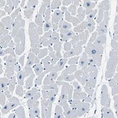Anti-PHKG1 antibody produced in rabbit Prestige Antibodies&#174; Powered by Atlas Antibodies, affinity isolated antibody, buffered aqueous glycerol solution