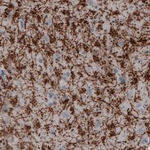 Monoclonal Anti-MBP antibody produced in mouse Prestige Antibodies&#174; Powered by Atlas Antibodies, clone CL2829, purified immunoglobulin, buffered aqueous glycerol solution