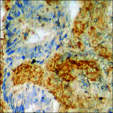 Anti-phospho-ITGB4 (pTyr1510) antibody produced in rabbit affinity isolated antibody