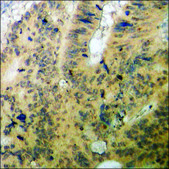 Anti-phospho-C-RAF (pSer296) antibody produced in rabbit affinity isolated antibody