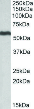 Anti-ALDH5A1 antibody produced in goat affinity isolated antibody, buffered aqueous solution