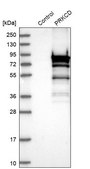 Anti-PRKCD antibody produced in rabbit Ab2, Prestige Antibodies® Powered by Atlas Antibodies, affinity isolated antibody, buffered aqueous glycerol solution