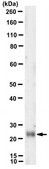 Anti-CD70 Antibody, clone FR70