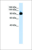 Anti-ACTN3 antibody produced in rabbit affinity isolated antibody